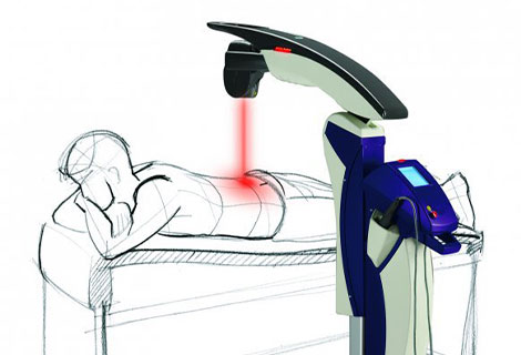 M6 Laser Therapy for neuropathy relief